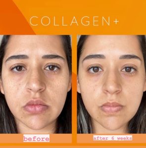 Our-blend-of-Antioxidants_-Ceramides-and-Collagen-Peptides-offers___Helps-support-collagen-and-elastin-formation__Supports-skin-hydration-and-healthy-moistu-295x300-1